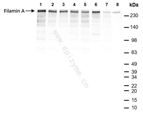 Anti-Filamin A Rabbit mAb [28R89L14]