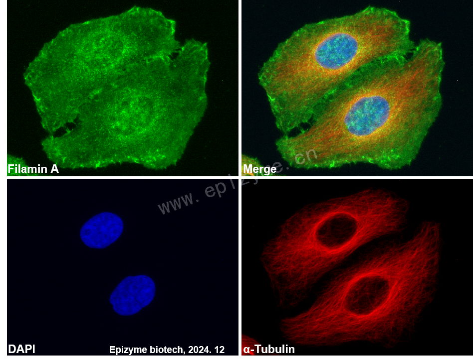 Anti-Filamin A Rabbit mAb [28R89L14]