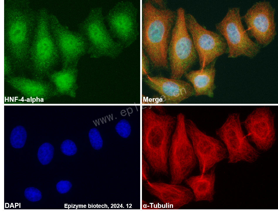 Anti-HNF-4-alpha Rabbit mAb [82E23C27]
