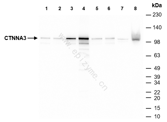 Anti-CTNNA3 Rabbit mAb [27F73P79]