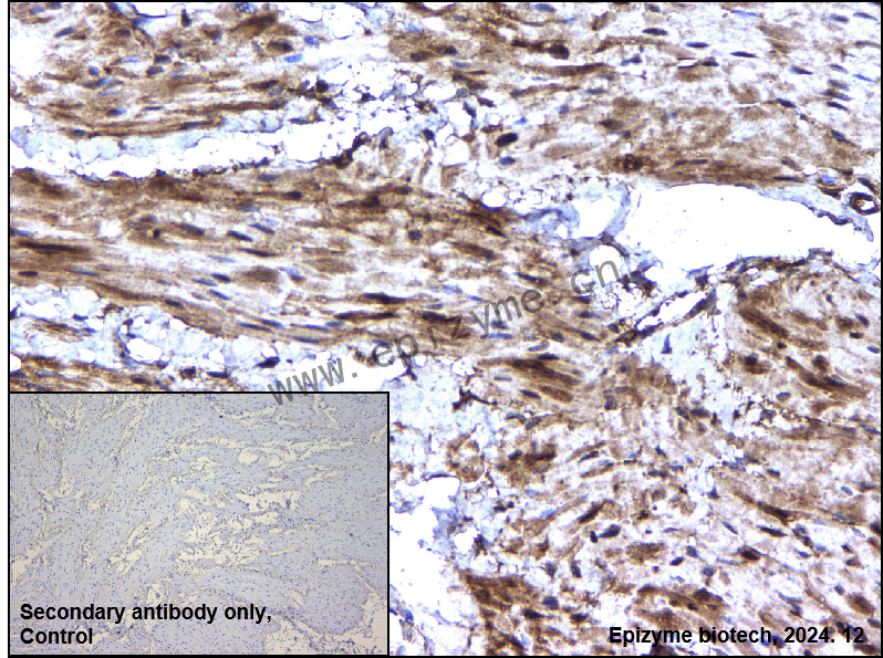 Anti-CTNNA3 Rabbit mAb [27F73P79]