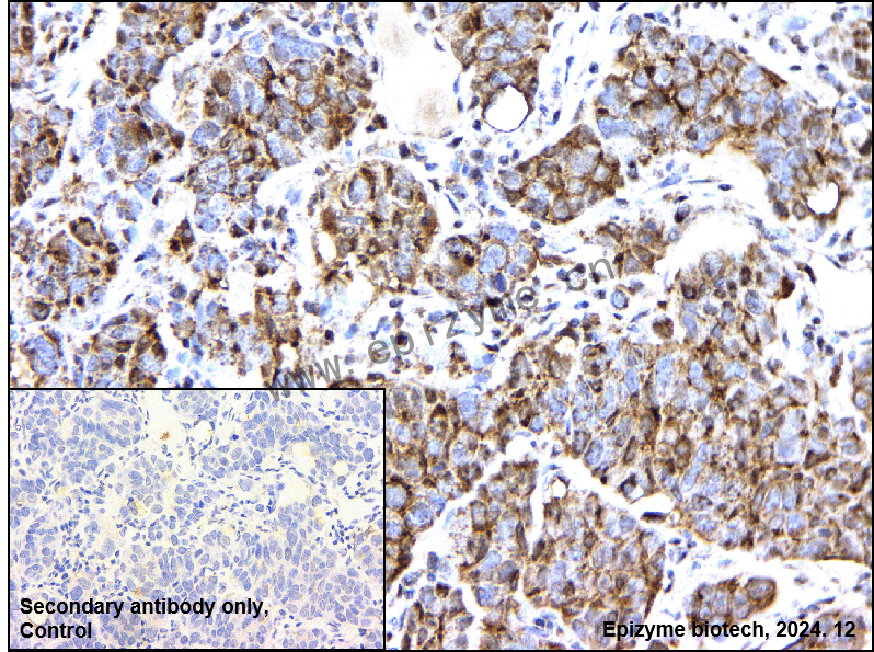Anti-CDC42EP1 Rabbit mAb [70C28R67]