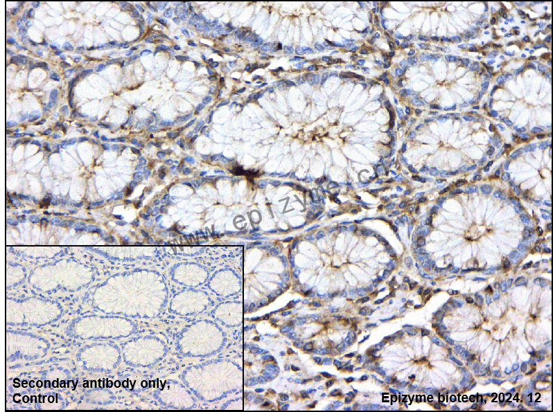 Anti-CDC42EP1 Rabbit mAb [70C28R67]
