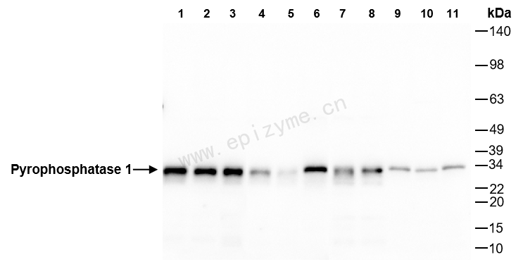 Anti-Pyrophosphatase 1 Rabbit mAb [65Q17B81]