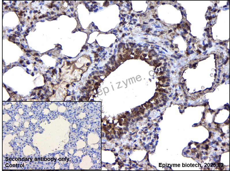 Anti-Pyrophosphatase 1 Rabbit mAb [65Q17B81]