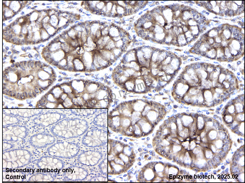 Anti-Pyrophosphatase 1 Rabbit mAb [65Q17B81]