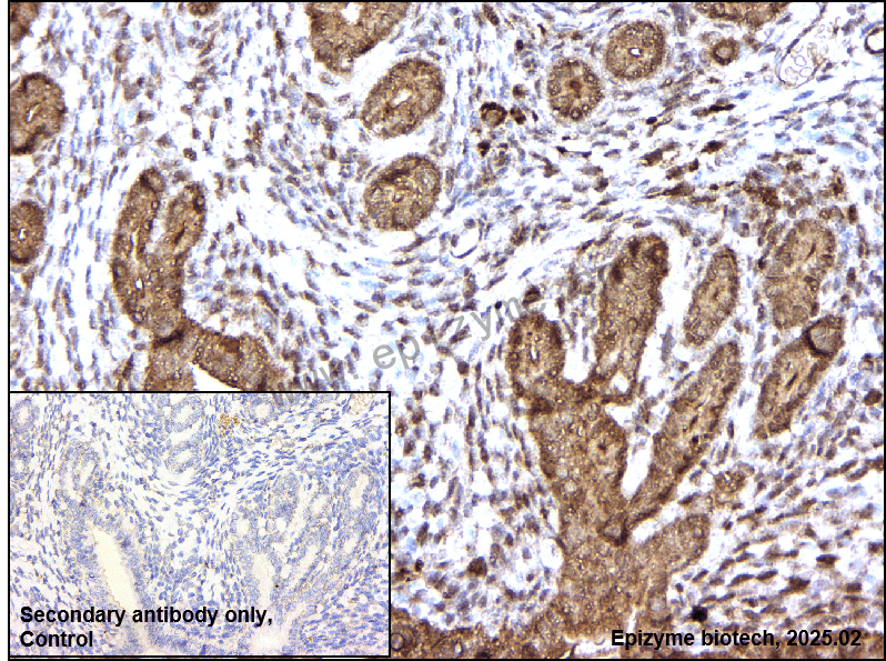 Anti-Pyrophosphatase 1 Rabbit mAb [65Q17B81]