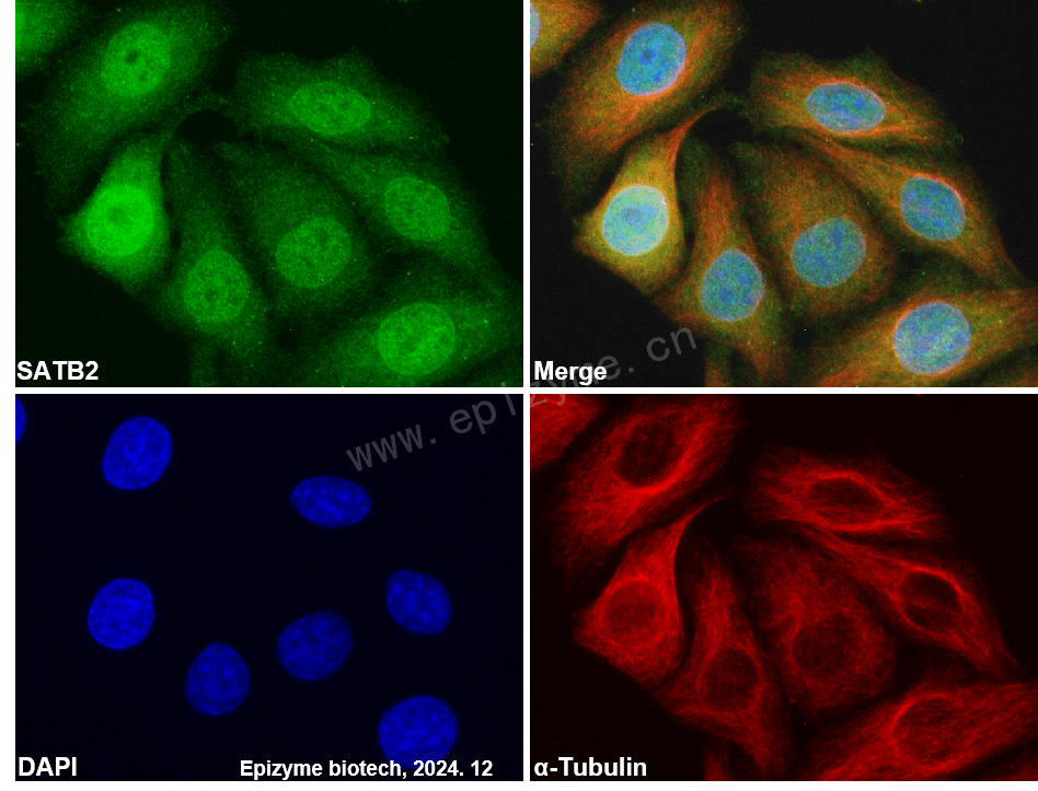 Anti-SATB2 Rabbit mAb [97P15N72]