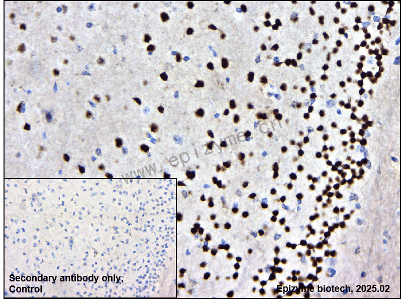 Anti-SATB2 Rabbit mAb [97P15N72]