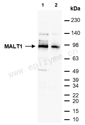 Anti-MALT1/MLT Rabbit mAb [67S48H67]
