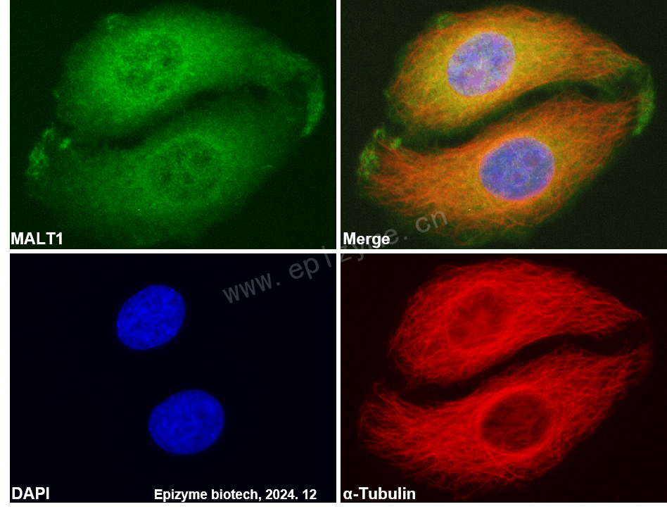 Anti-MALT1/MLT Rabbit mAb [67S48H67]