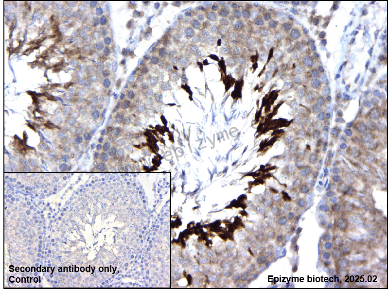 Anti-MALT1/MLT Rabbit mAb [67S48H67]
