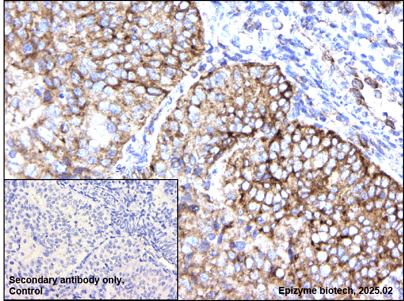 Anti-MALT1/MLT Rabbit mAb [67S48H67]