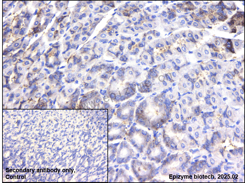 Anti-MALT1/MLT Rabbit mAb [67S48H67]