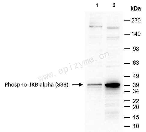 Anti-Phospho-IKB alpha (Ser36) Rabbit mAb [49R90B50]