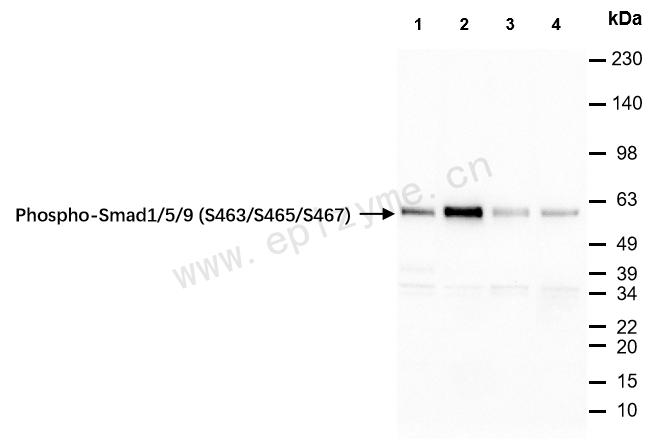 Anti-Phospho-Smad1/5/9 (Ser463/Ser465/Ser467) Rabbit mAb [64M70A53]
