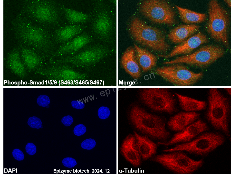 Anti-Phospho-Smad1/5/9 (Ser463/Ser465/Ser467) Rabbit mAb [64M70A53]