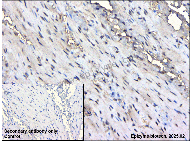 Anti-Phospho-Smad1/5/9 (Ser463/Ser465/Ser467) Rabbit mAb [64M70A53]