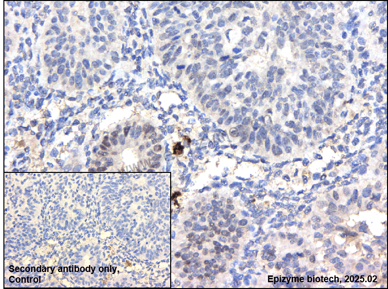 Anti-Phospho-Smad1/5/9 (Ser463/Ser465/Ser467) Rabbit mAb [64M70A53]