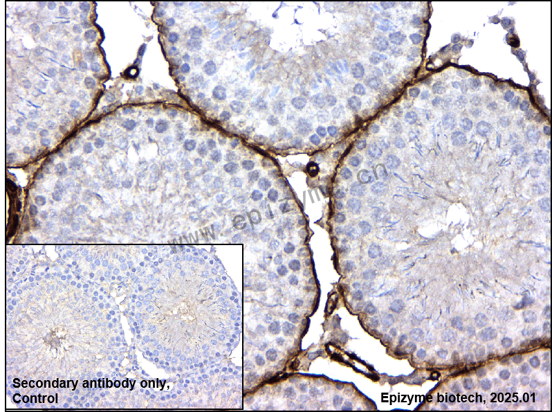 Anti-Caldesmon Rabbit mAb [44I42E94]