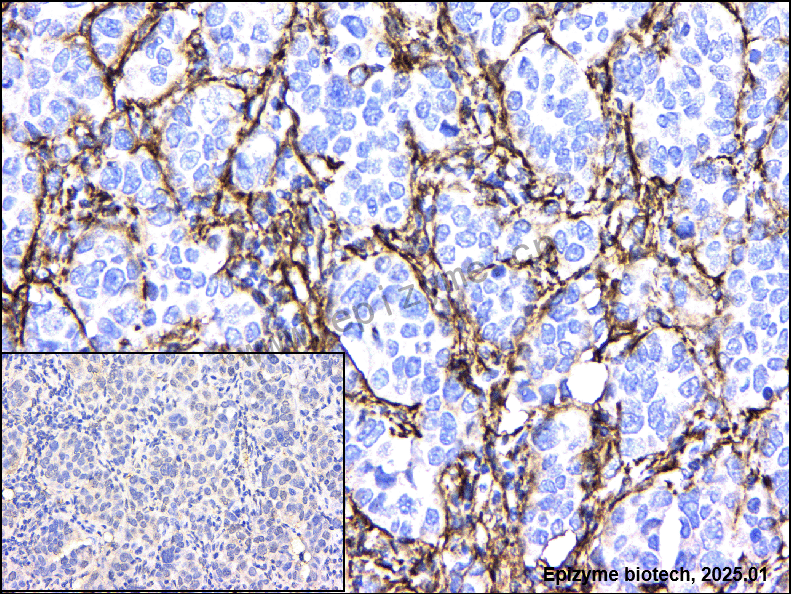 Anti-Caldesmon Rabbit mAb [44I42E94]