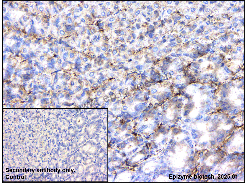 Anti-Caldesmon Rabbit mAb [44I42E94]