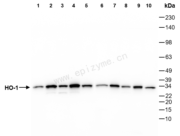 Anti-Heme Oxygenase 1 Rabbit mAb [58Q07H13]