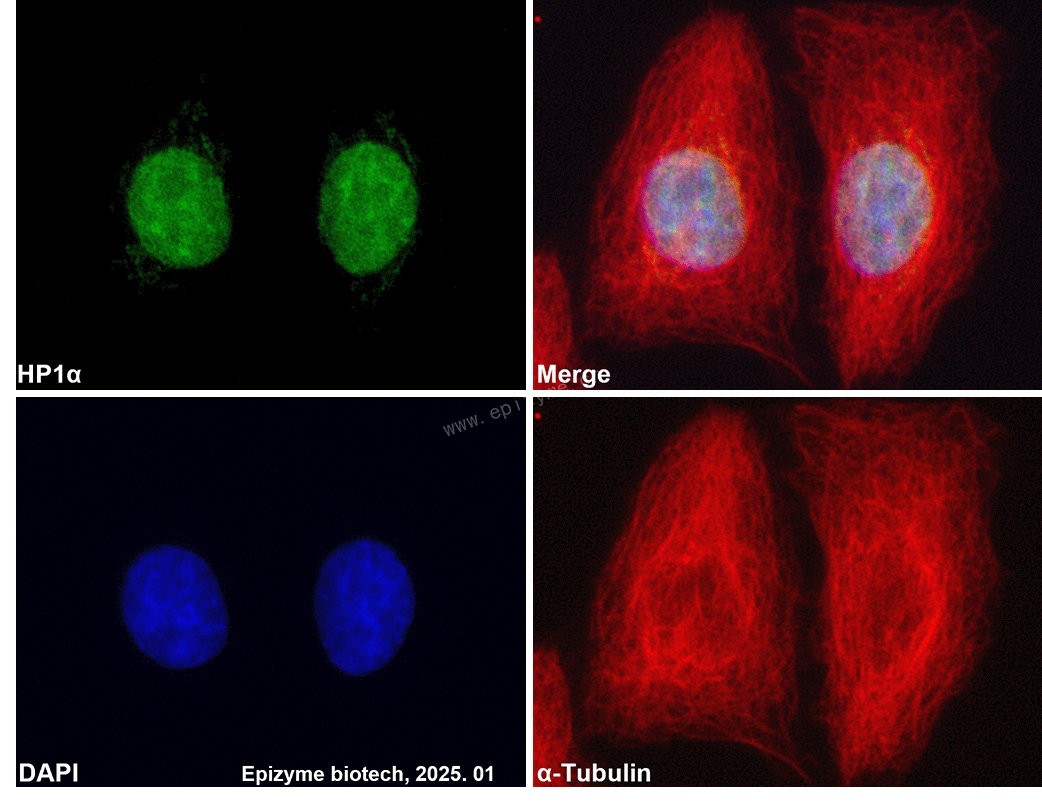 Anti-HP1 alpha Rabbit mAb [41D96H95]