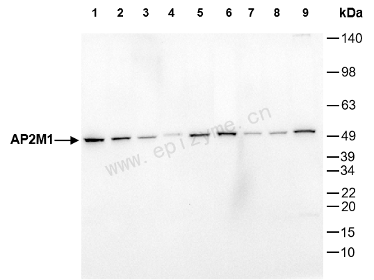 Anti-AP2M1 Rabbit mAb [86S95F85]