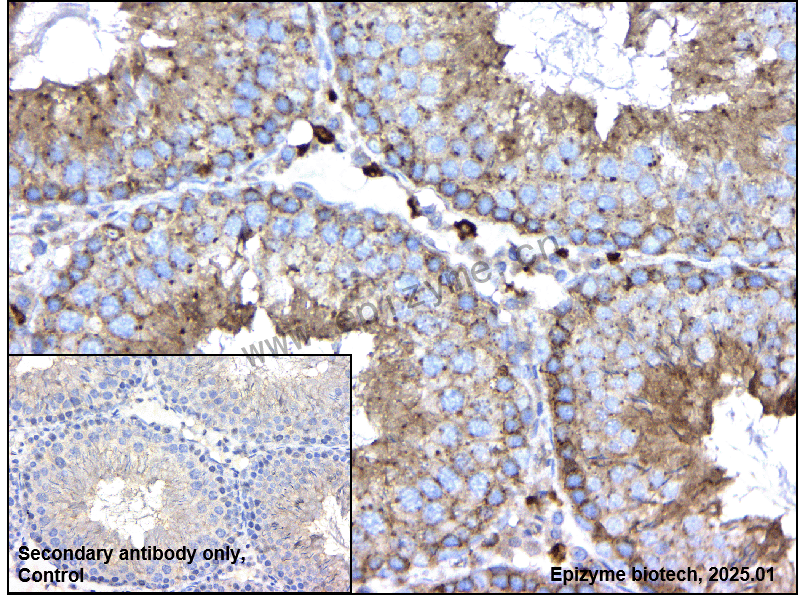 Anti-AP2M1 Rabbit mAb [86S95F85]