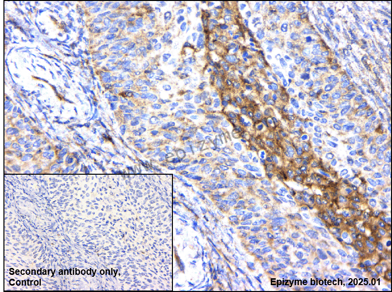 Anti-AP2M1 Rabbit mAb [86S95F85]