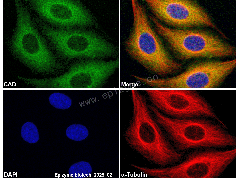 Anti-CAD/DFFB Rabbit mAb [39S91M22]