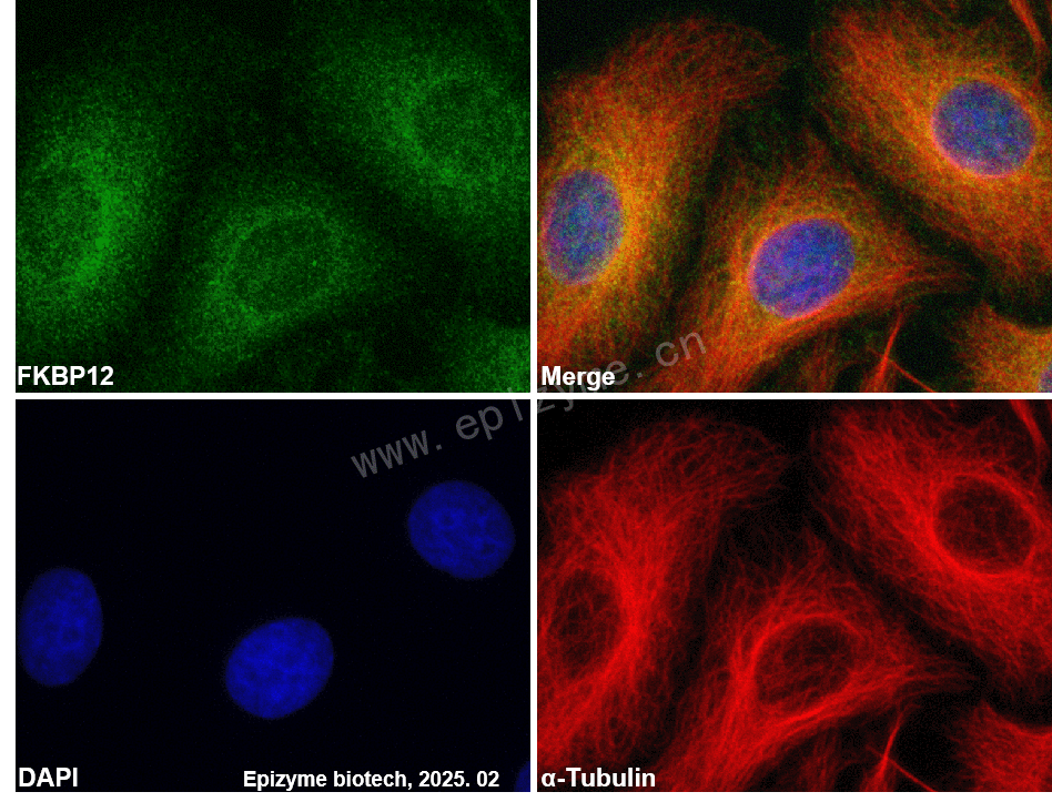 Anti-FKBP12 Rabbit mAb [21M16T26]