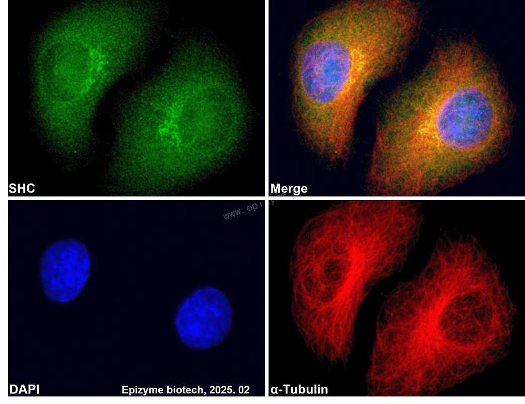 Anti-SHC Rabbit mAb [97D40L72]