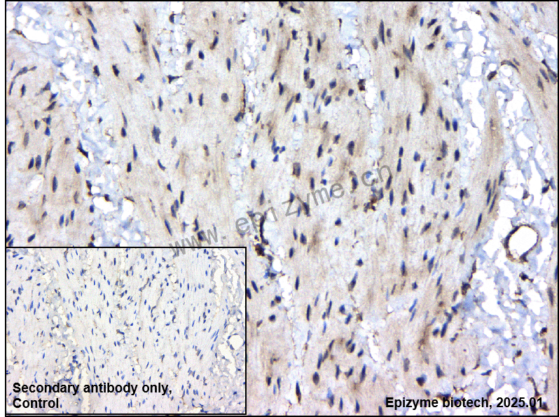 Anti-BAG1 Rabbit mAb [72I06E58]