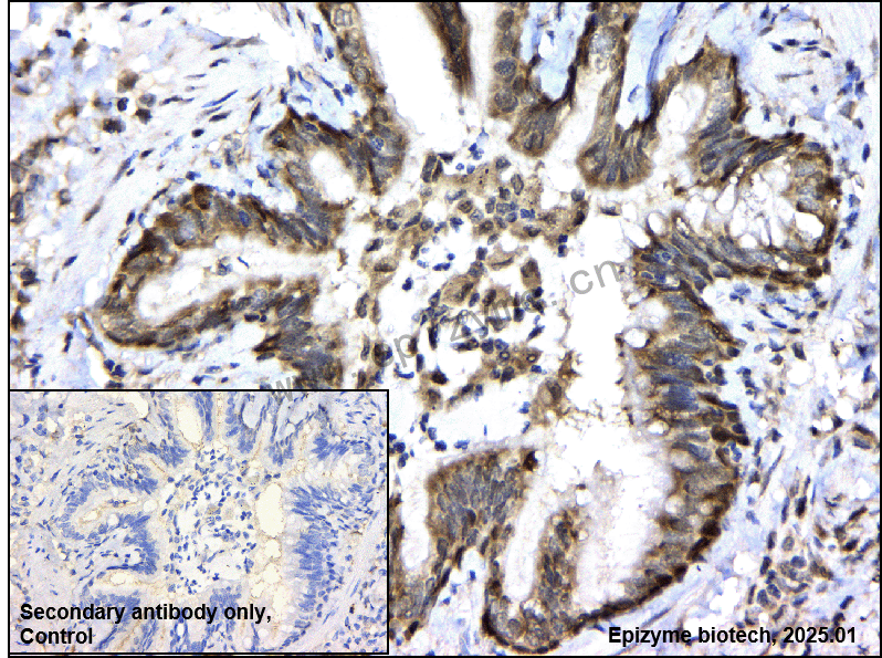 Anti-BAG1 Rabbit mAb [72I06E58]