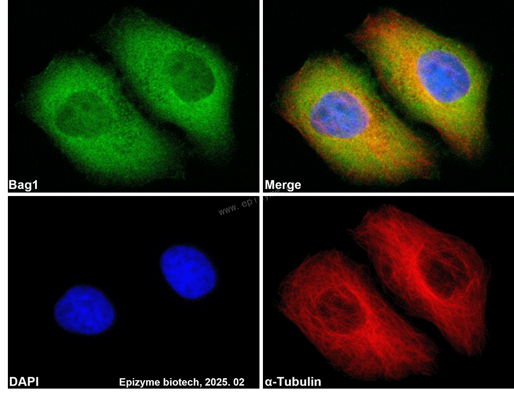 Anti-BAG1 Rabbit mAb [72I06E58]