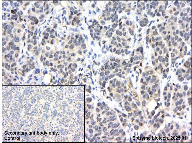 Anti-EGR1 Rabbit mAb [11R52C06]