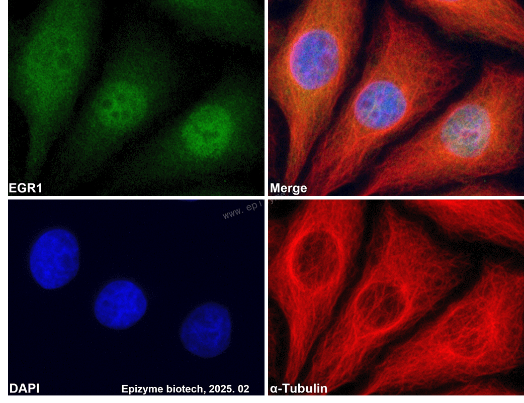 Anti-EGR1 Rabbit mAb [11R52C06]