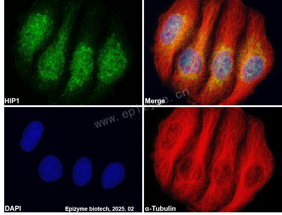 Anti-HIP1 Rabbit mAb [82P66K77]