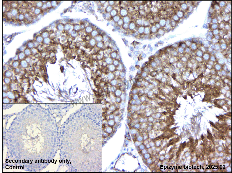 Anti-HIP1 Rabbit mAb [82P66K77]