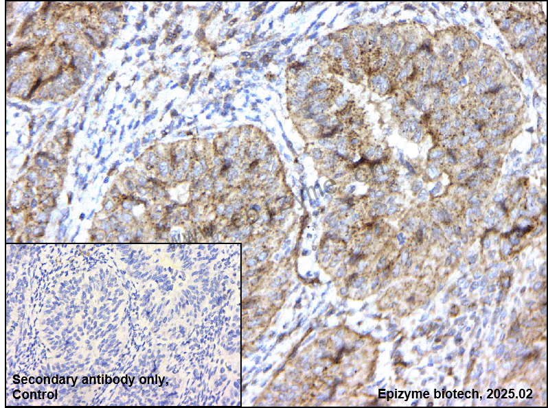 Anti-HIP1 Rabbit mAb [82P66K77]