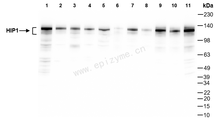 Anti-HIP1 Rabbit mAb [82P66K77]