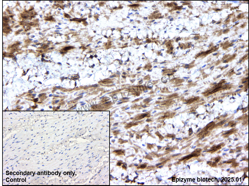 Anti-Glutamine Synthetase Rabbit mAb [63T53F67]