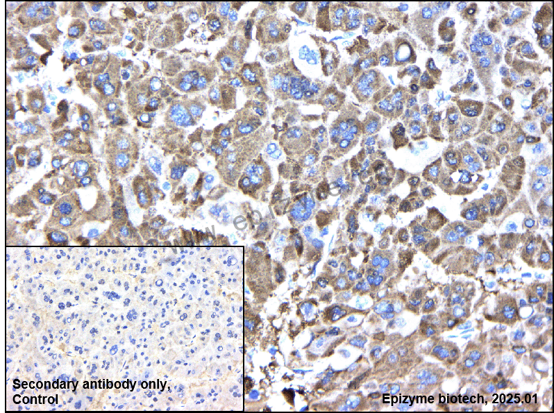 Anti-Glutamine Synthetase Rabbit mAb [63T53F67]