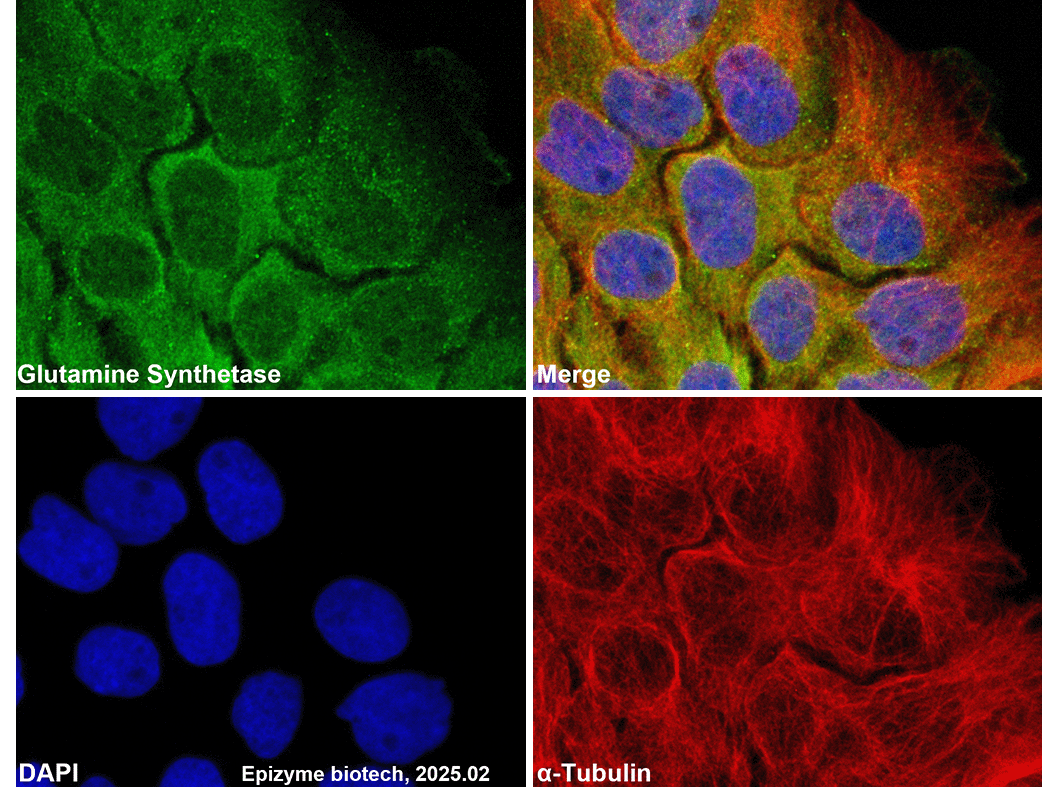 Anti-Glutamine Synthetase Rabbit mAb [63T53F67]