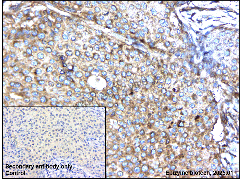 Anti-DENN Rabbit mAb [26C81C46]