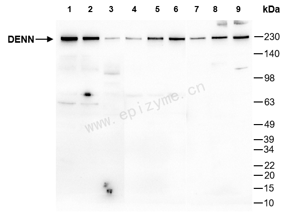 Anti-DENN Rabbit mAb [26C81C46]