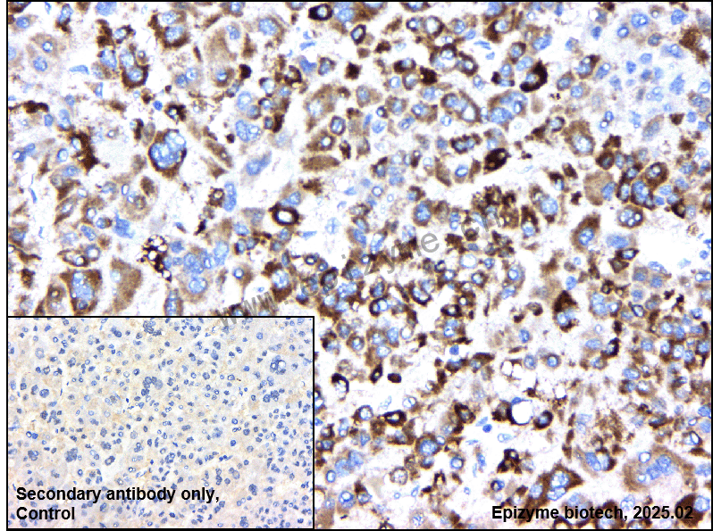 Anti-HMGCS2 Rabbit mAb [16L26A85]
