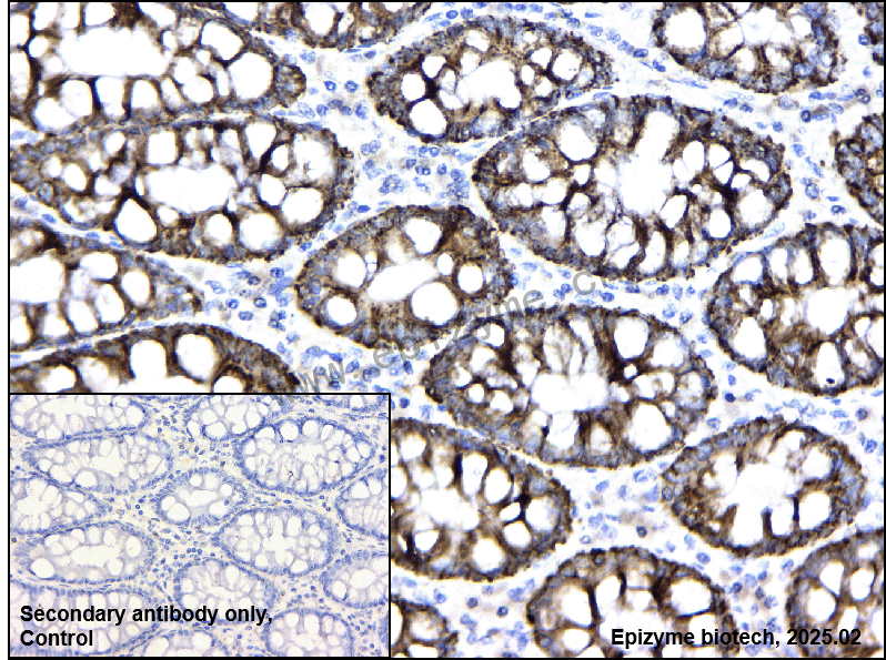 Anti-HMGCS2 Rabbit mAb [16L26A85]